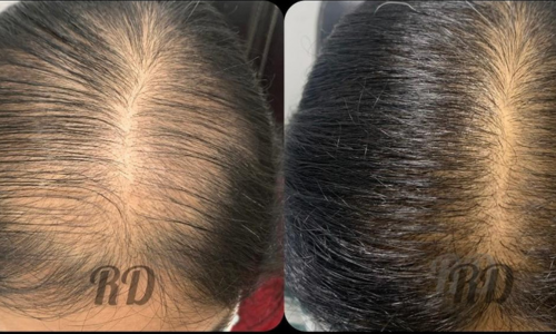 Before and after result 3