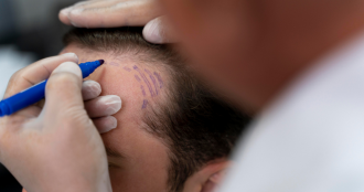 Hairgen Booster Therapy for Hair Loss