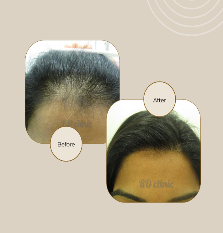 Hair Treatment Banner