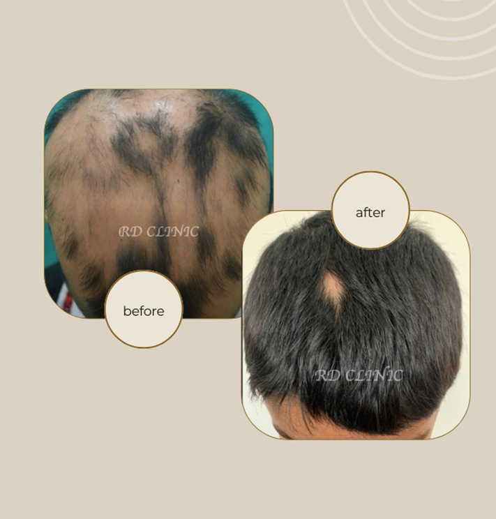 Hair Regrowth Banner