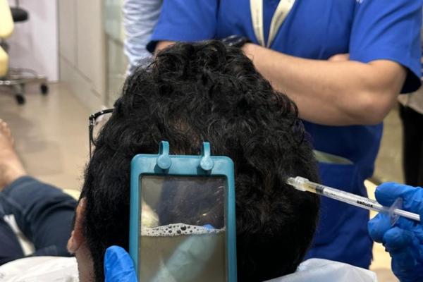 Natural Growth Factor Therapies for Hair Regeneration